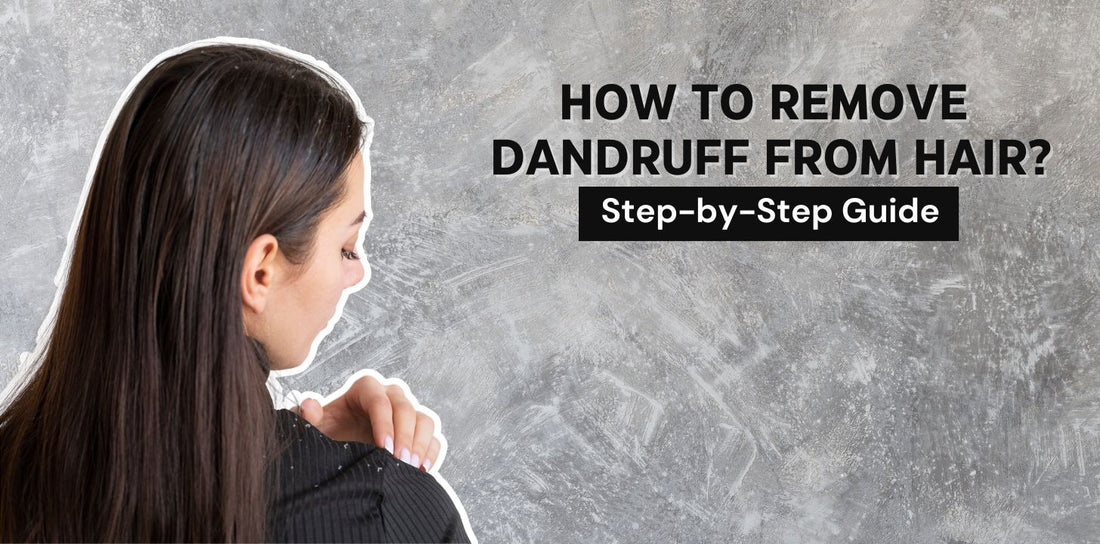 How to Remove Dandruff from Hair? A Step-By-Step Hair Care Regime