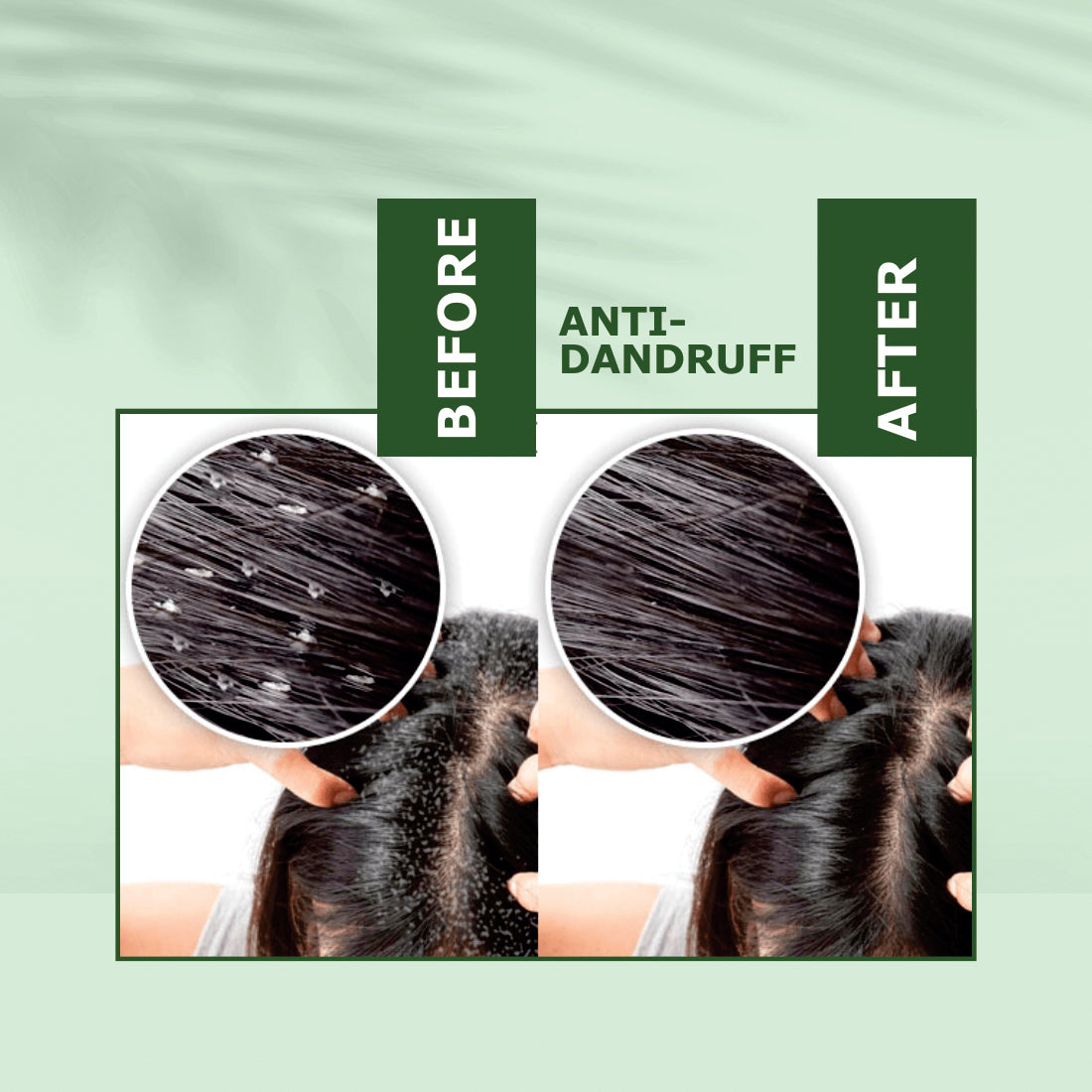 Anti-Dandruff Hair Oil