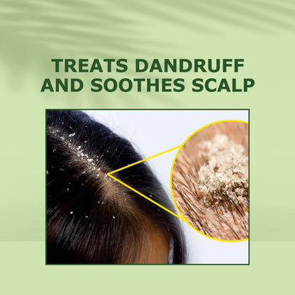 Tea Tree Rosemary Oil treats dandruff