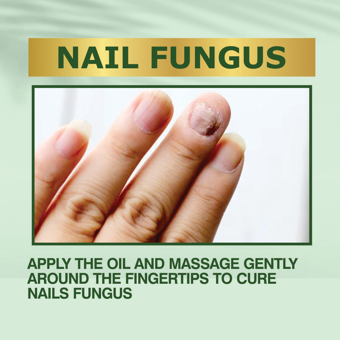 Nail Fungus